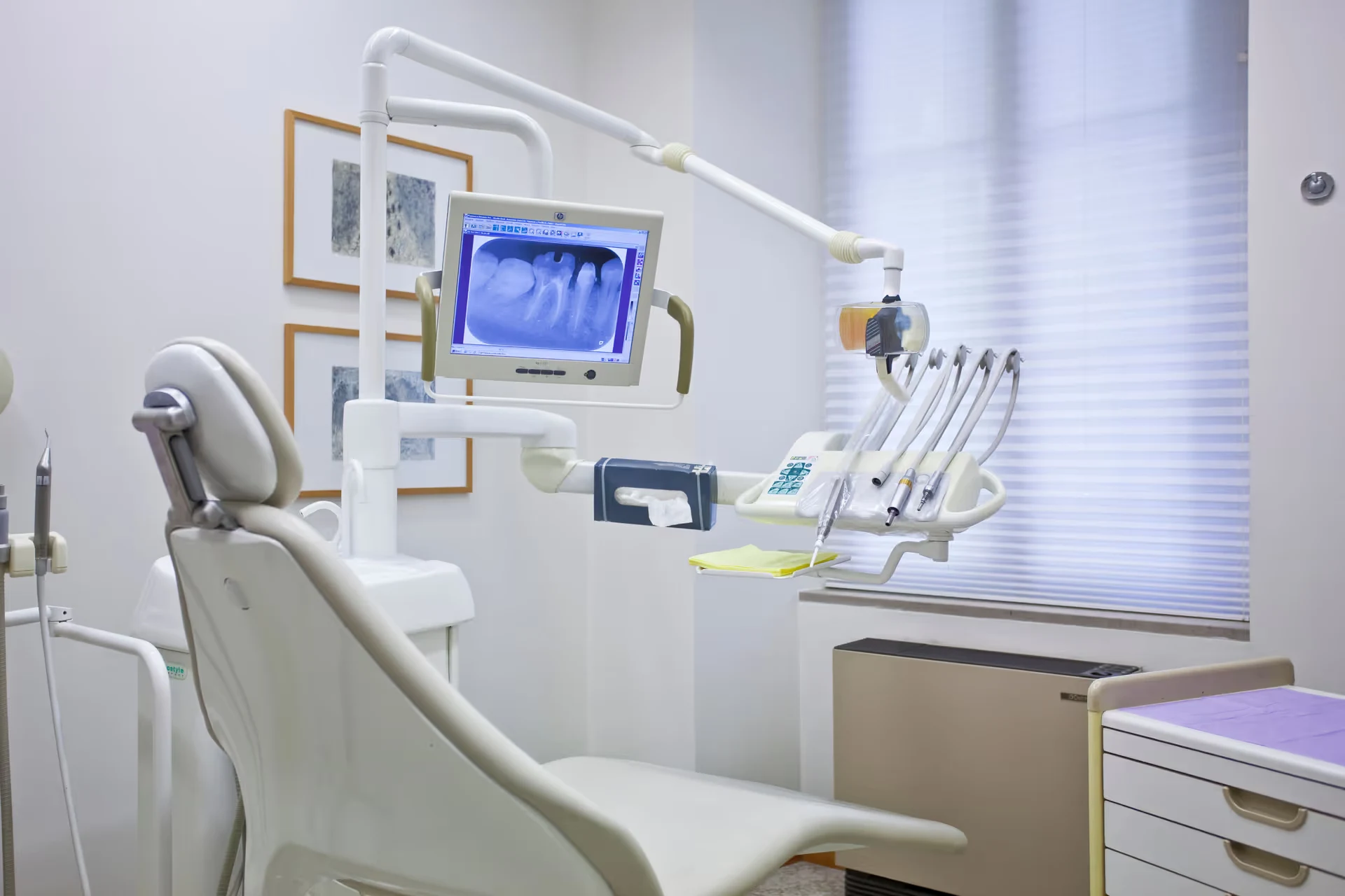 Modern dental treatment room at Epic Dental with chair and diagnostic equipment